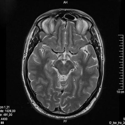 avatar for Bossi@mastodon.social