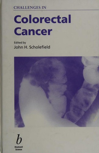 John Scholefield: Challenges in Colorectal Cancer (Challenges in) (2000, Blackwell Publishing, Incorporated)